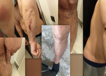 FOTO / Protestuesit e Rrjollit rrahin brutalisht pas emisionit djalin e trashëgimtarit të tokës