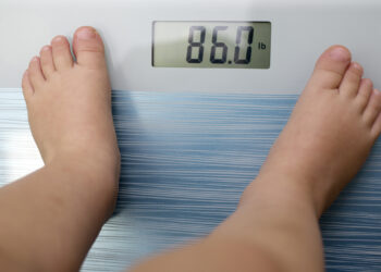 Raporti ndërkombëtar: Deri në 227 milionë fëmijë mund të jenë obezë në vitin 2040