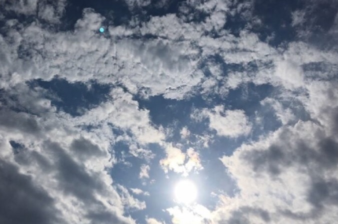 Shi dhe vranësira gjatë gjithë ditës  përmirësim i përkohshëm pas mesditës