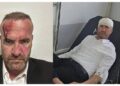 Sulmi ndaj zëvendësministrit, intervistohen dëshmitarë dhe të dyshuar për incidentin në Skenderaj