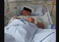 59-vjeçarja shqiptare pëson hemorragji cerebrale dhe mbetet në Danimarkë, familja kërkon mbështetje për ta shpëtuar