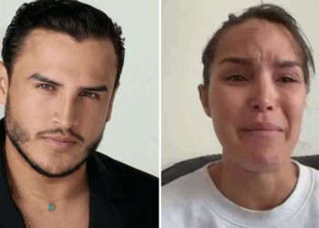 Sulmohet në Kanë “Miss Venezuela 2025”, publikon videon me fytyrën e përgjakur, akuzon stilistin e njohur