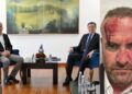 Dhunohet zv.ministri dhe kreu i LVV-së në Skënderaj, Vetëvendosje publikon fotot dhe akuzat e forta