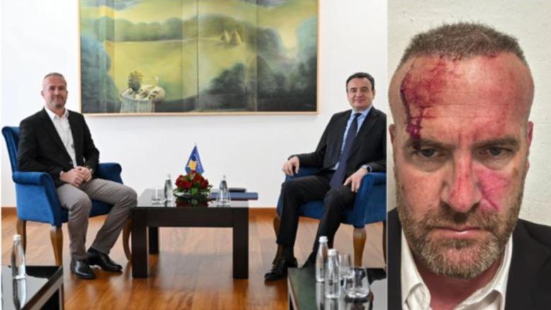 Dhunohet zv ministri dhe kreu i LVV së në Skënderaj  Vetëvendosje publikon fotot dhe akuzat e forta