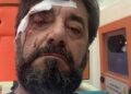 FOTO/ Dhunohet gazetari Ilir Demalia