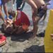 Vrojtuesi i plazhit i shpëton jetën 67-vjeçarit që po lahej në Velipojë, doli nga deti në gjendje kritike