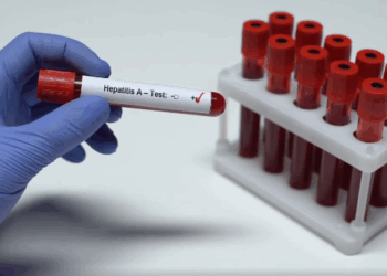Dita Botërore e Hepatiteve, MSH: Miratohet për herë të parë Plani Kombëtar për Eliminimin e Hepatiteve Virale