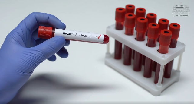 Dita Botërore e Hepatiteve  MSH  Miratohet për herë të parë Plani Kombëtar për Eliminimin e Hepatiteve Virale