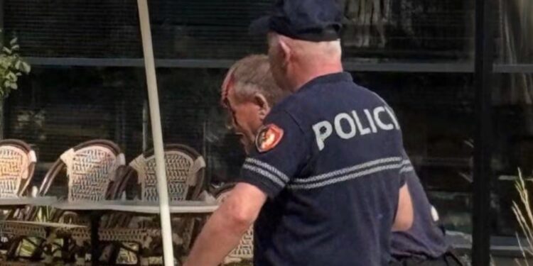 Një polic i gjakosur gjatë protestës së djeshme