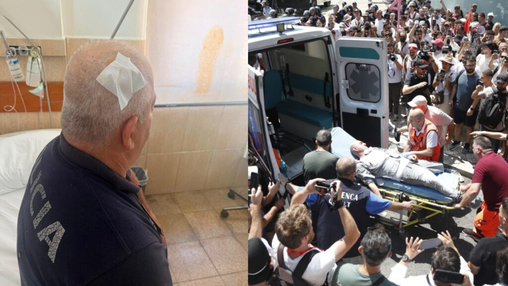 Dhuna para Parlamentit, 11 protestues dhe 6 efektivë paraqiten në QSUT dhe te Trauma, ja gjendja e tyre