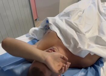 “Flakë, tym…”/ Pushuesi tregon si u hodh nga ballkoni për t’i shpëtuar zjarrit në Vlorë