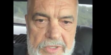 “Merren me shtrembërimin e hundës”, Rama: Kjo është një shenjë që trupi im do ta mbajë gjithë jetën