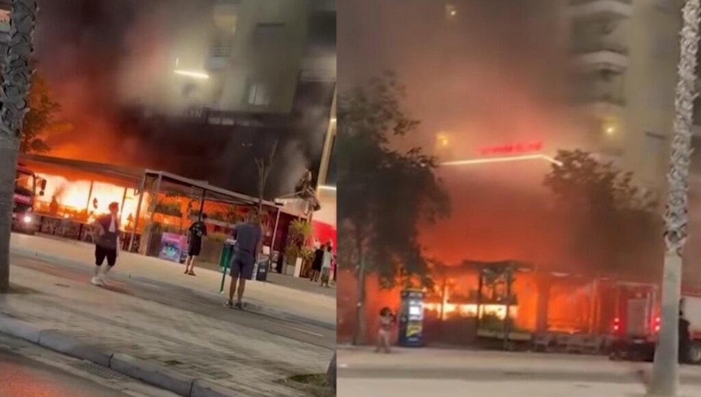 Zjarri në Vlorë, 25-vjeçarja me djegie të rënda dërgohet në Turqi. Shpenzimet mbulohen nga shteti shqiptar