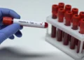 Shqipëria miraton për herë të parë planin kombëtar kundër hepatiteve virale, Rama: Synimi, parandalimi i rasteve të reja dhe ulja e kancerit të mëlçisë