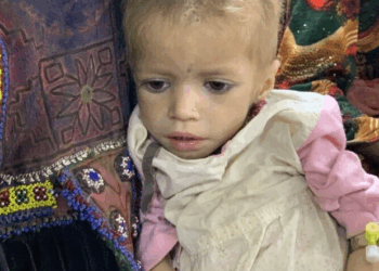UNICEF raportoi se 3.7 milionë fëmijë në Afganistan vuajnë nga kequshqyerja -