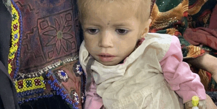 UNICEF raportoi se 3.7 milionë fëmijë në Afganistan vuajnë nga kequshqyerja -