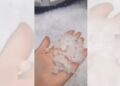 Kapriçot e motit, gjysmë ore breshër në zonat e Devollit, dyshohet për dëme të mëdha në bujqësi