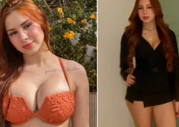 Tronditje në rrjetet sociale, influencerja e njohur vdes në moshën 22-vjeçare disa javë pas operacionit në gjoks